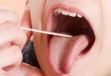 Can tonsils grow back after they've been removed