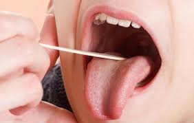 Can tonsils grow back after they've been removed